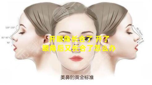 开眼角长合了 开了眼角后又长合了怎么办